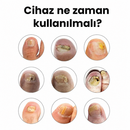Calvens™ Tırnak Bakım Cihazı